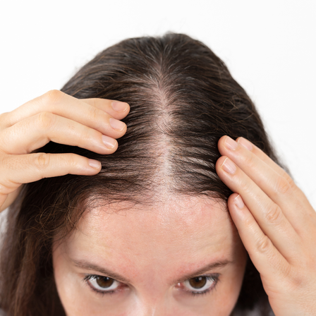 Le cuir chevelu, la clé de cheveux en bonne santé